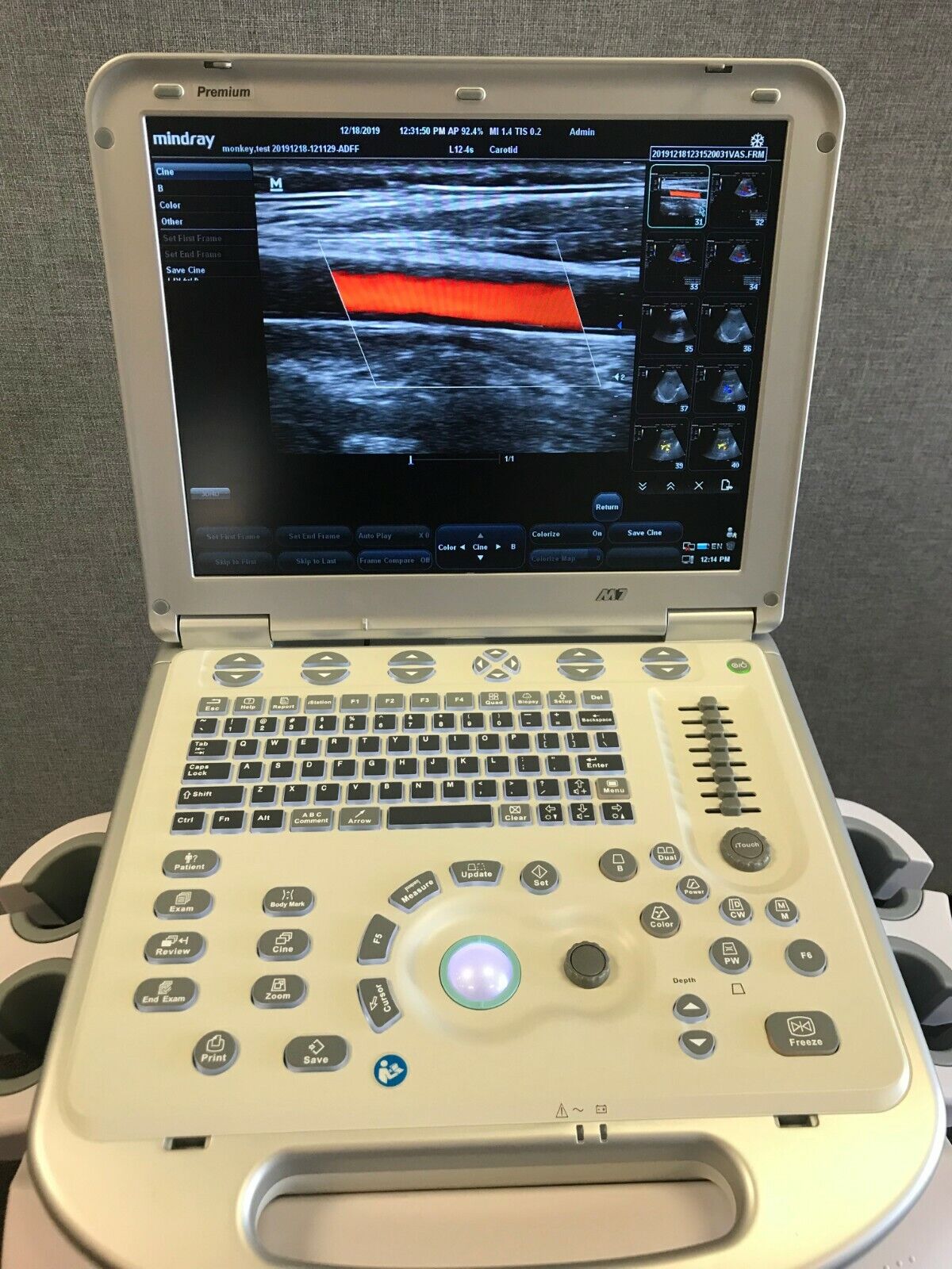 Mindray M7 Ultrasound Machine in vendita - foto 1