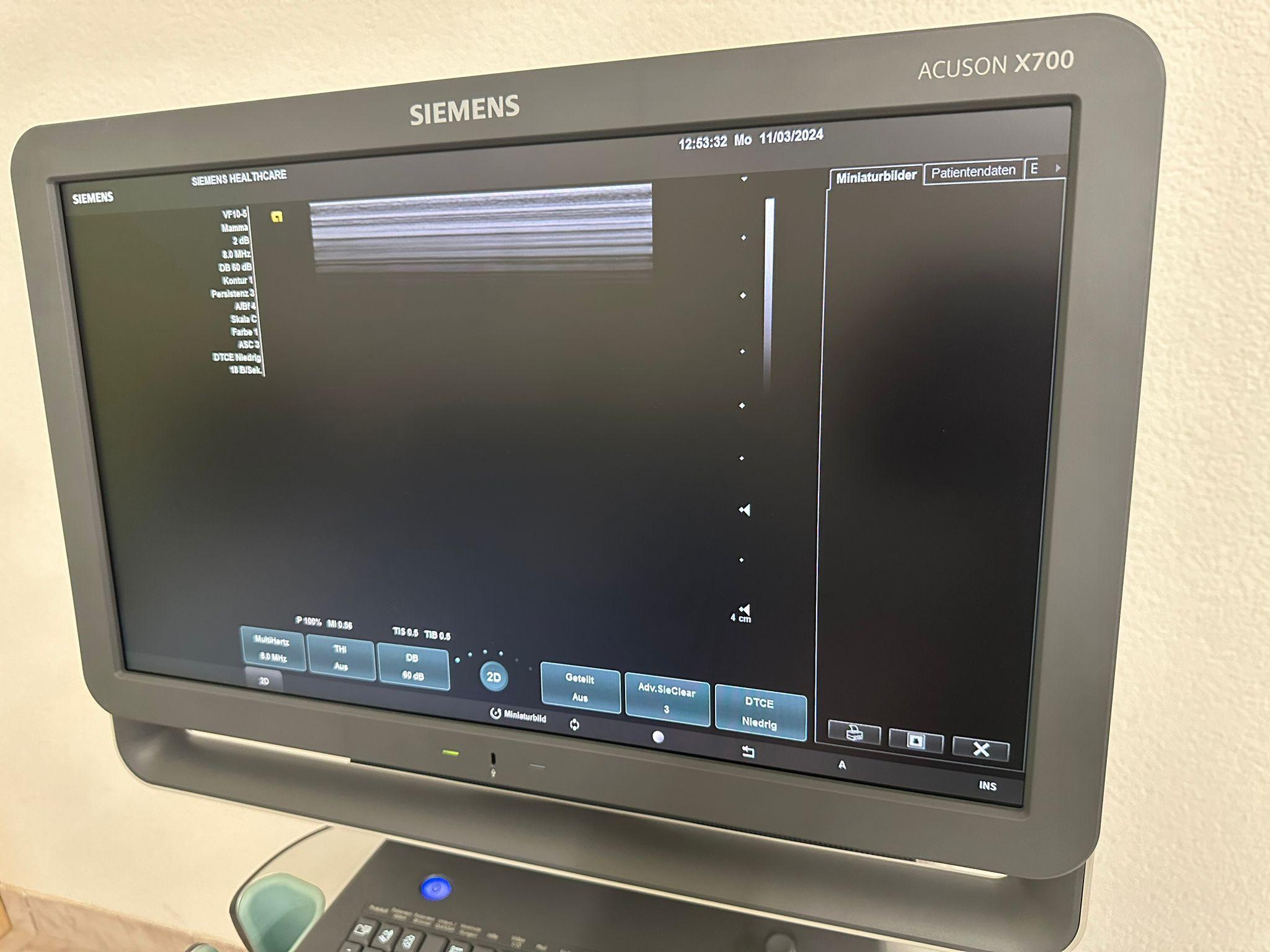 Ultrasuono SIEMENS ACUSON X700 in vendita - foto 6