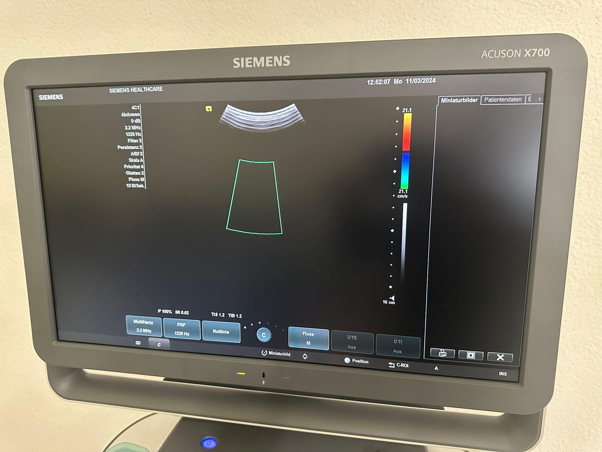 Ultrasuono SIEMENS ACUSON X700 in vendita - foto 5