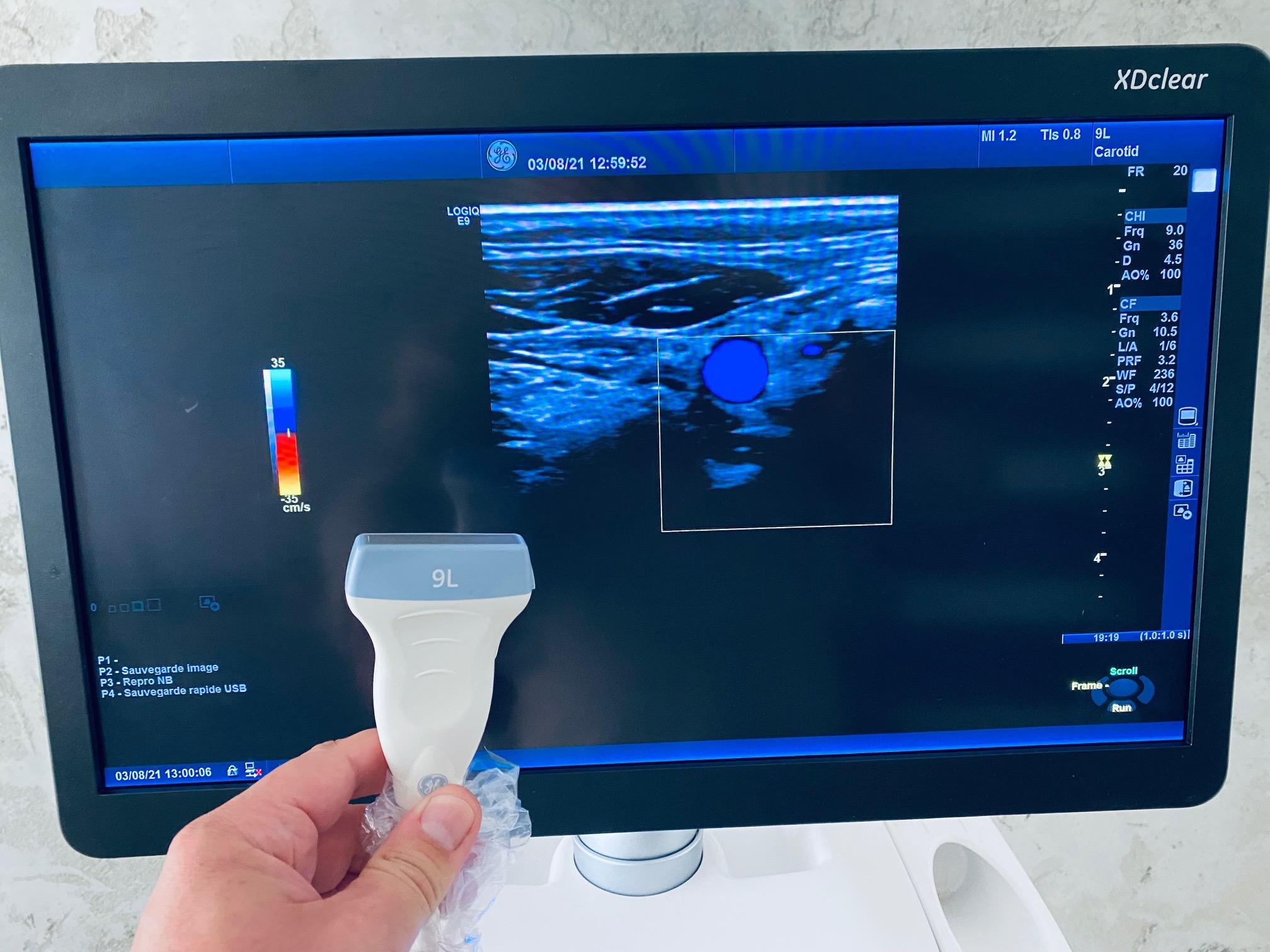 Ultrasuono GE Logiq E9 XDclear in vendita - foto 5