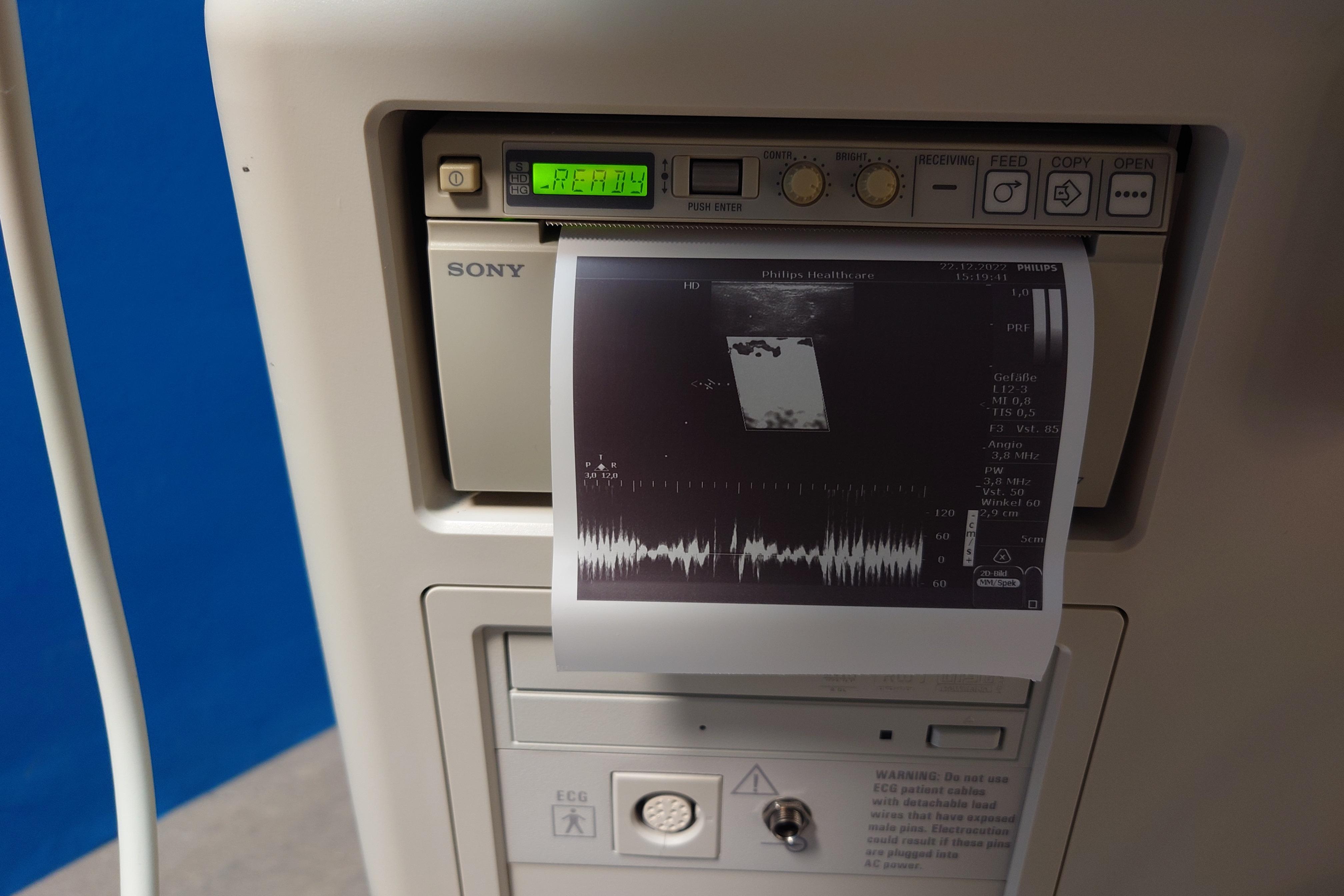 Ultrasuono PHILIPS HD7 XE in vendita - foto 4