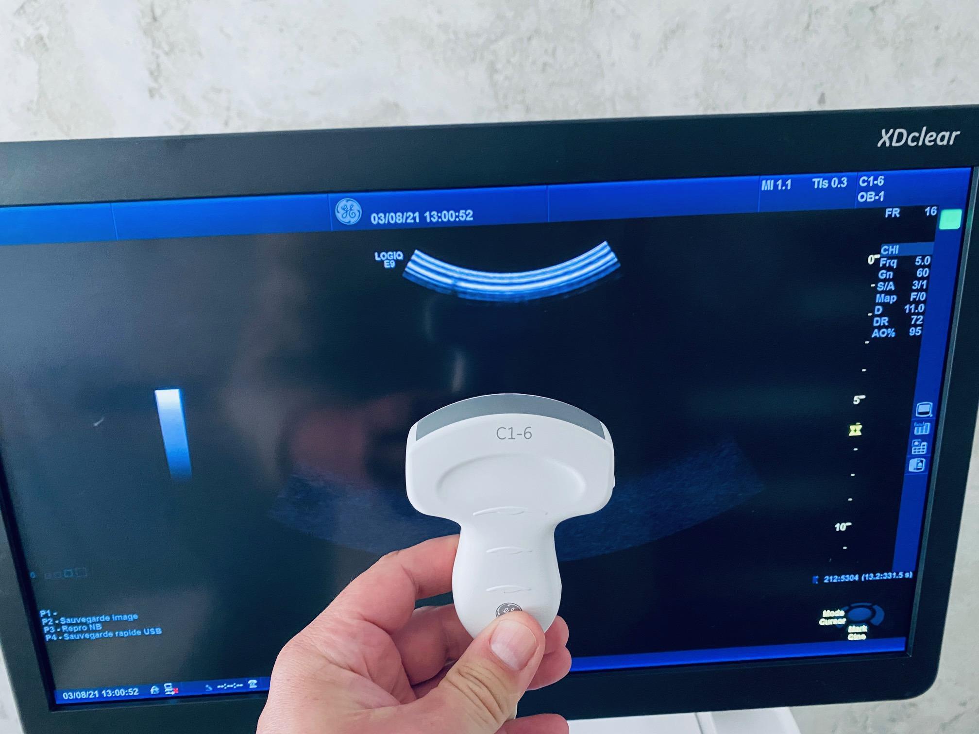 Ultrasuono GE Logiq E9 XDclear in vendita - foto 4