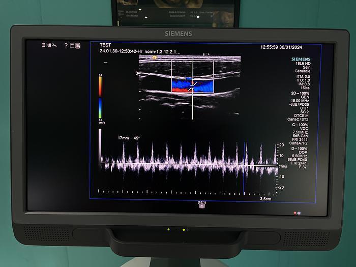 Ultrasuono SIEMENS ACUSON S2000 HELX Evoluzione in vendita - foto 4